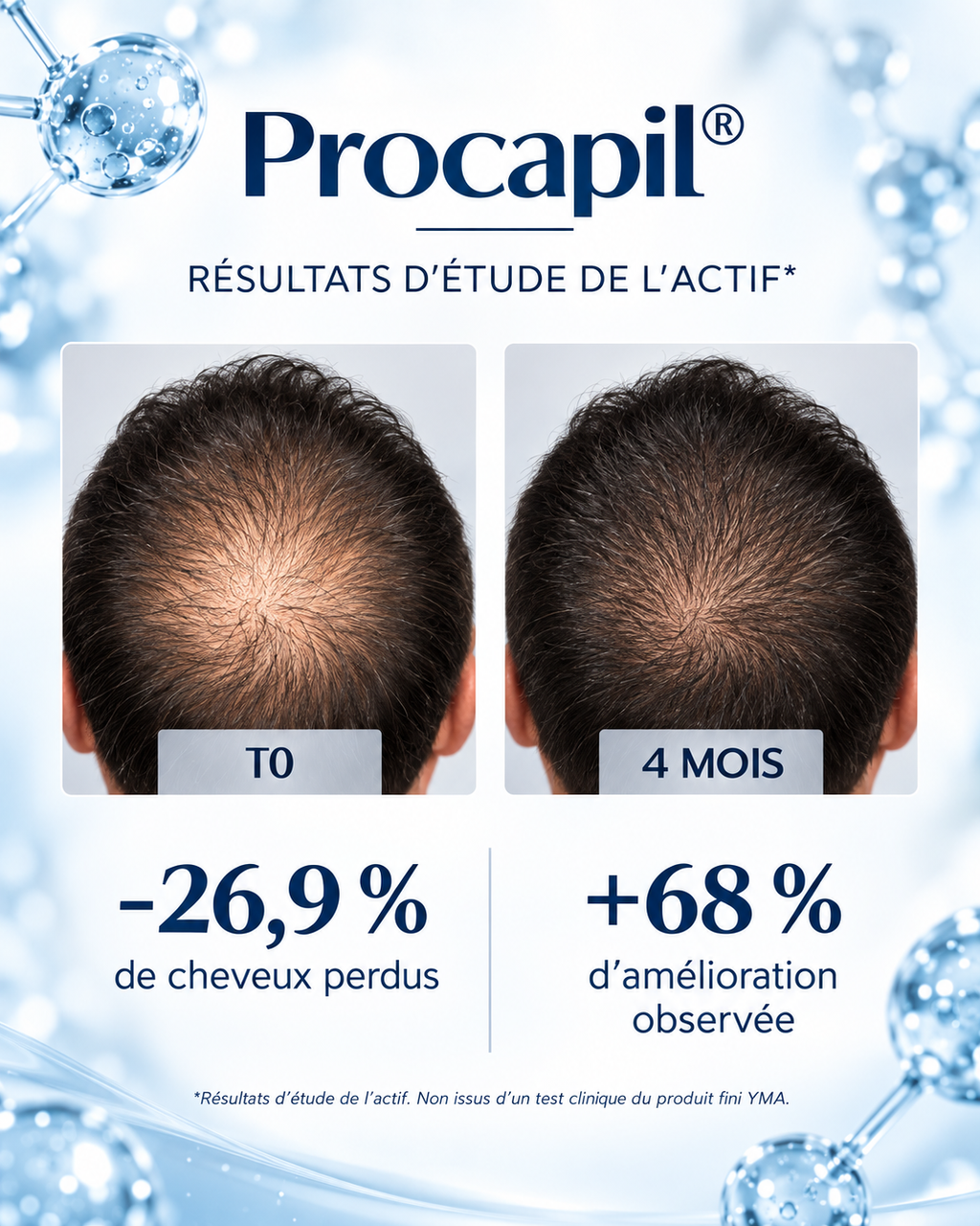 Dermo-Scalp Anti-Chute – 50 ml